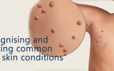 Recognising and Treating common baby skin conditions